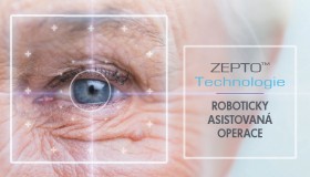 NOVINKA V OCP: ZEPTO technologie