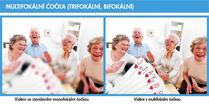 OCP multifokální čočka