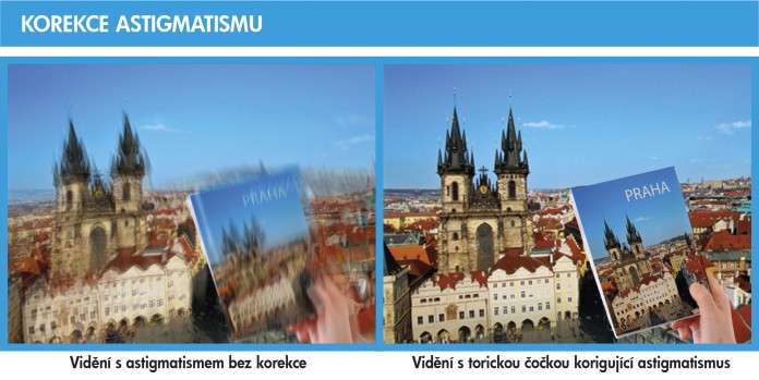 OCP torická čočka