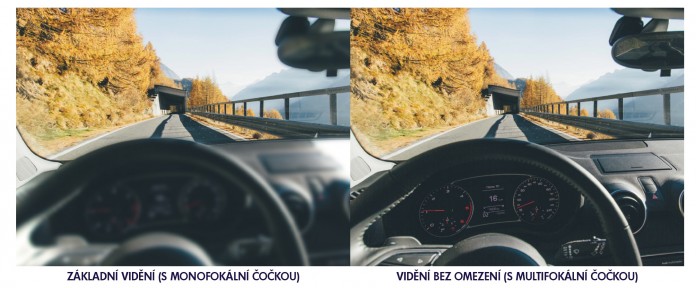 OCP vidění s multifokální trifokální čočkou